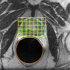 Given probe-in image with MRS grid