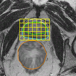 Predicted probe-in image with MRS grid