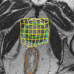 Given probe-out image with predicted MRS grid